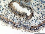 CYR61 Antibody in Immunohistochemistry (Paraffin) (IHC (P))