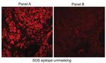 Carbonic Anhydrase IX Antibody in Immunohistochemistry (Paraffin) (IHC (P))