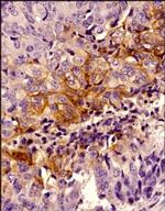 Carbonic Anhydrase IX Antibody in Immunohistochemistry (Paraffin) (IHC (P))