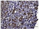 HIF1A Antibody in Immunohistochemistry (Paraffin) (IHC (P))