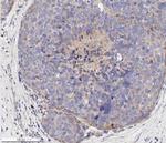 VEGF Receptor 1/2 Antibody in Immunohistochemistry (Paraffin) (IHC (P))