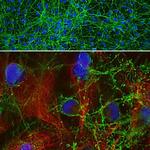 GAP43 Antibody in Immunocytochemistry (ICC/IF)