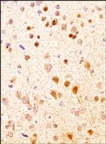 NKB Antibody in Immunohistochemistry (Paraffin) (IHC (P))