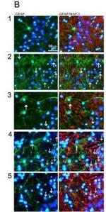 MAP2 Antibody in Immunocytochemistry (ICC/IF)