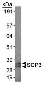 SCP3 Antibody in Western Blot (WB)