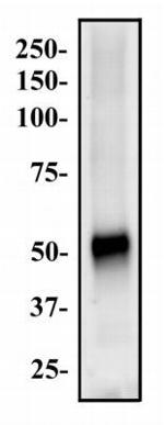 ABCG8 Antibody in Western Blot (WB)