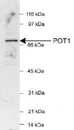 POT1 Antibody in Western Blot (WB)