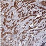 Survivin Antibody in Immunohistochemistry (Paraffin) (IHC (P))