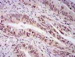 Survivin Antibody in Immunohistochemistry (Paraffin) (IHC (P))