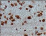 JARID2 Antibody in Immunohistochemistry (Paraffin) (IHC (P))