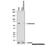 Calreticulin Antibody in Western Blot (WB)