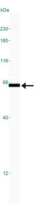 Calreticulin Antibody in Western Blot (WB)