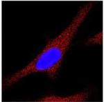 LC3A/LC3B Antibody in Immunocytochemistry (ICC/IF)