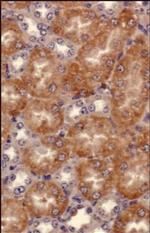 SEMA3B Antibody in Immunohistochemistry (Paraffin) (IHC (P))