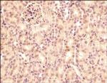 SEMA3B Antibody in Immunohistochemistry (Paraffin) (IHC (P))