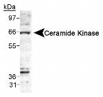 CERK Antibody in Western Blot (WB)