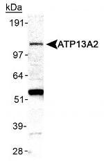 ATP13A2 Antibody in Western Blot (WB)