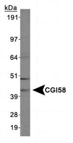 CGI58 Antibody in Western Blot (WB)