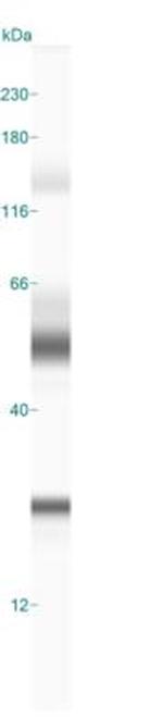 CGI58 Antibody in Western Blot (WB)