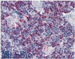 SLP76 Antibody in Immunohistochemistry (Paraffin) (IHC (P))