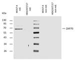 Zap-70 Antibody in Western Blot (WB)