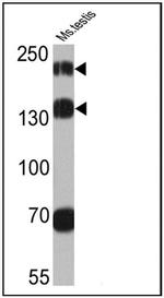 PSME4 Antibody in Western Blot (WB)