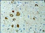 KIF3A Antibody in Immunohistochemistry (Paraffin) (IHC (P))