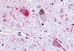 GPR43 Antibody in Immunohistochemistry (Paraffin) (IHC (P))