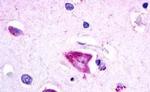 GALR3 Antibody in Immunohistochemistry (Paraffin) (IHC (P))