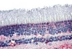 PNR Antibody in Immunohistochemistry (Paraffin) (IHC (P))