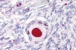 NR5A1 Antibody in Immunohistochemistry (Paraffin) (IHC (P))