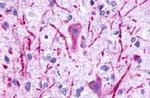 P2Y8 Antibody in Immunohistochemistry (Paraffin) (IHC (P))