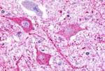 P2Y8 Antibody in Immunohistochemistry (Paraffin) (IHC (P))