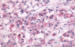 DRD1 Antibody in Immunohistochemistry (Paraffin) (IHC (P))