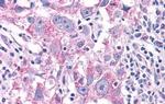 NEK6 Antibody in Immunohistochemistry (Paraffin) (IHC (P))