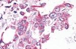 NEK6 Antibody in Immunohistochemistry (Paraffin) (IHC (P))