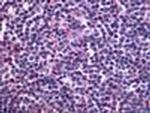 EDG6 Antibody in Immunohistochemistry (Paraffin) (IHC (P))