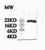 CRP Antibody in Western Blot (WB)