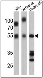 THRA Antibody in Western Blot (WB)