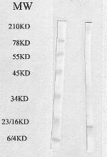 FABP4 Antibody in Western Blot (WB)