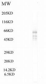 BRWD1 Antibody in Western Blot (WB)