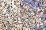 IL-22 Antibody in Immunohistochemistry (Paraffin) (IHC (P))