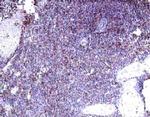 IL22RA2 Antibody in Immunohistochemistry (Paraffin) (IHC (P))