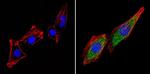 THRB Antibody in Immunocytochemistry (ICC/IF)