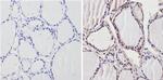 THRB Antibody in Immunohistochemistry (Paraffin) (IHC (P))