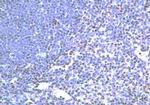 TLR2 Antibody in Immunohistochemistry (IHC)