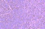 CCR5 Antibody in Immunohistochemistry (Paraffin) (IHC (P))