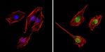 THRA Antibody in Immunocytochemistry (ICC/IF)