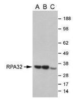 RPA2 Antibody in Western Blot (WB)