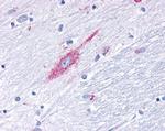 NFATC1 Antibody in Immunohistochemistry (IHC)